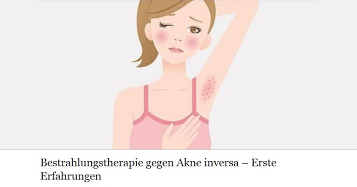 Titelbild des Artikels Bestrahlungstherapie gegen Akne inversa im Wirtschaftsmagazin für den Hautarzt